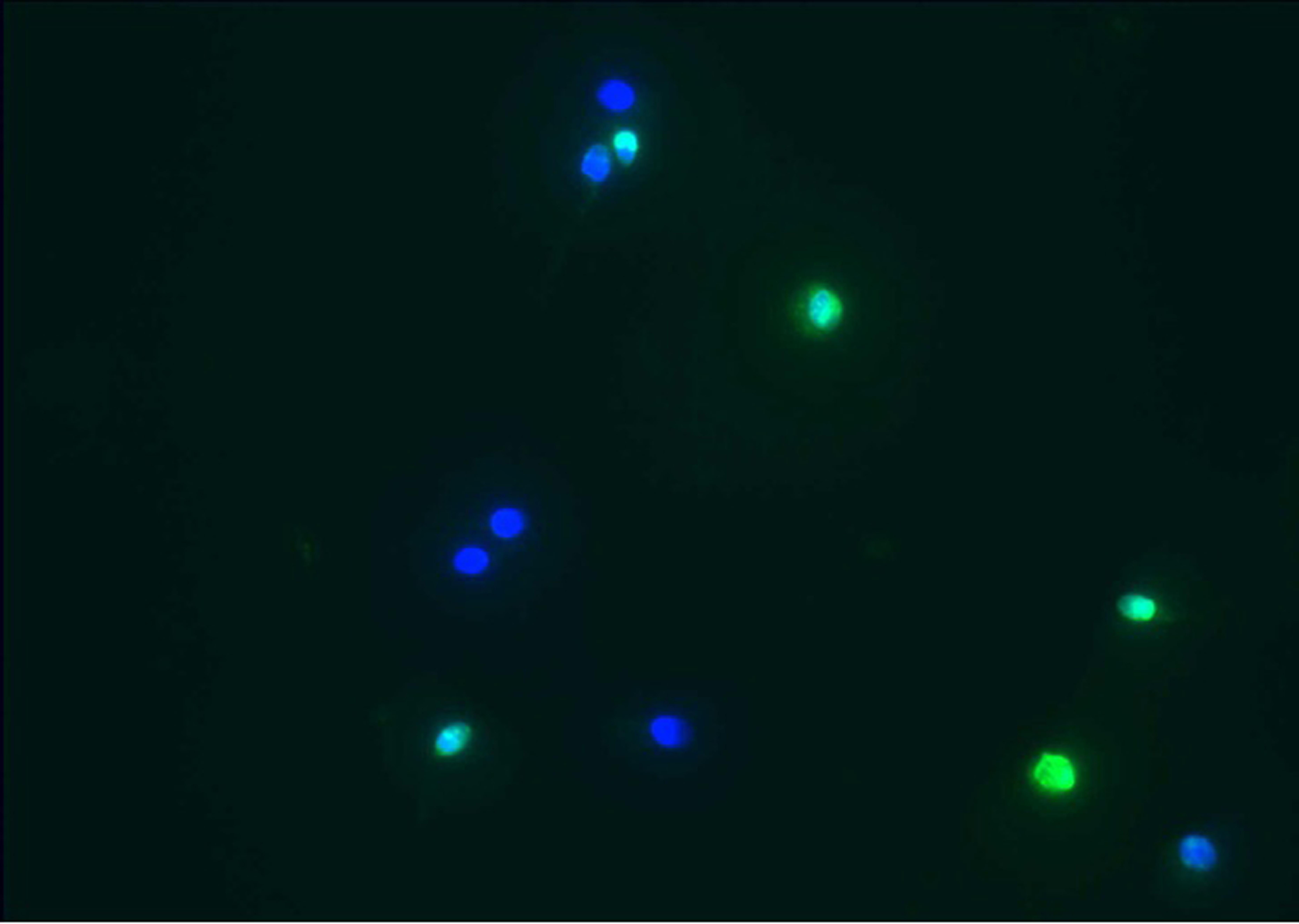 TUNEL assay